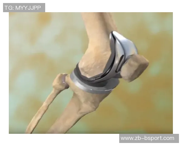 跟队：加维情况让人担心，他的膝盖问题出现在做过手术的右膝